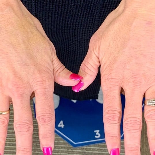 laser lipo and fat transfer Before & After Image