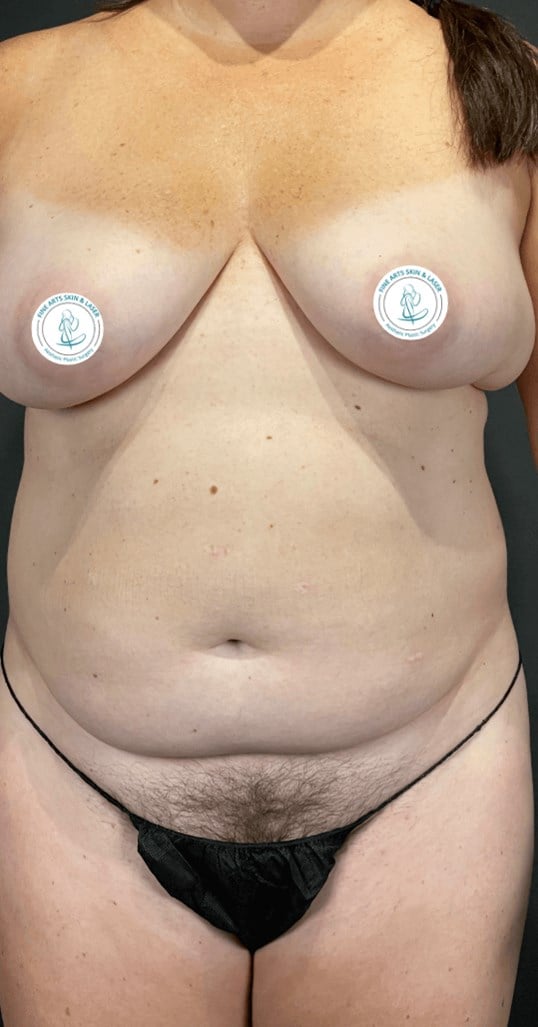 Pro Nox Before & After Image