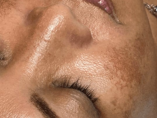 Jetpeel Pro Before & After Image